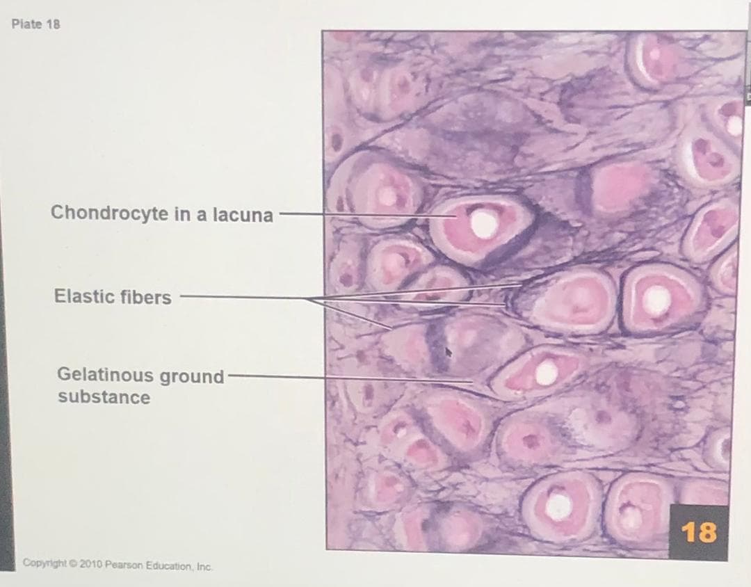 Piate 18
Chondrocyte in a lacuna
Elastic fibers
Gelatinous ground-
substance
18
Copyright 2010 Pearson Education, Inc.
