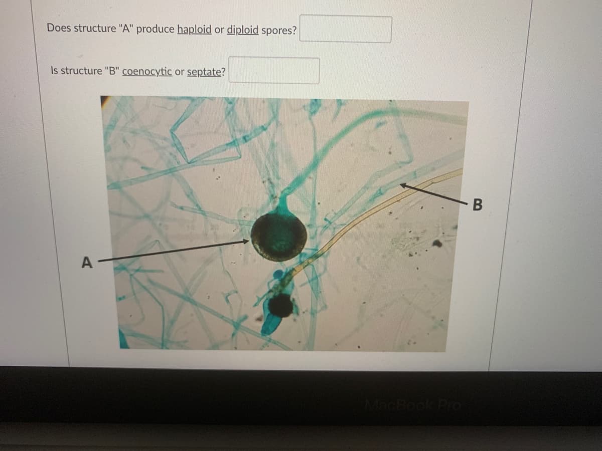 Does structure "A" produce haploid or diploid spores?
Is structure "B" coenocytic or septate?
A
MacBook Pro
