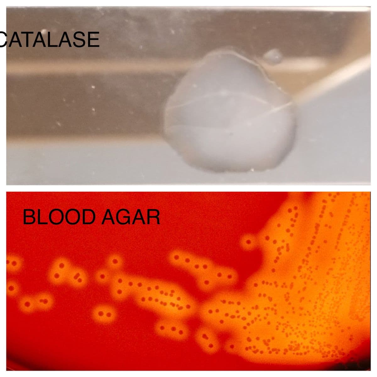 CATALASE
BLOOD AGAR
