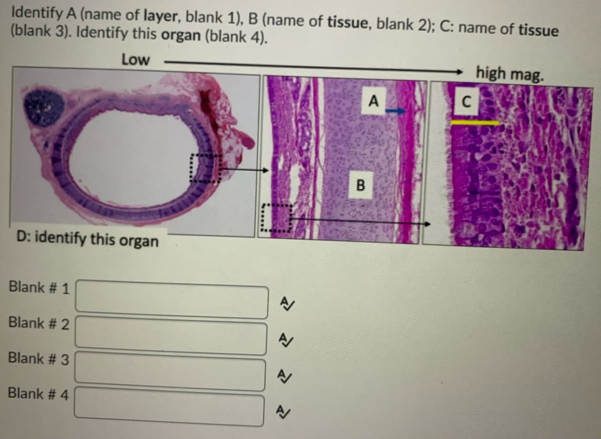 Identify A (name of layer, blank 1), B (name of tissue, blank 2); C: name of tissue
(blank 3). Identify this organ (blank 4).
Low
high mag.
C
D: identify this organ
Blank # 1
Blank # 2
Blank # 3
Blank # 4
