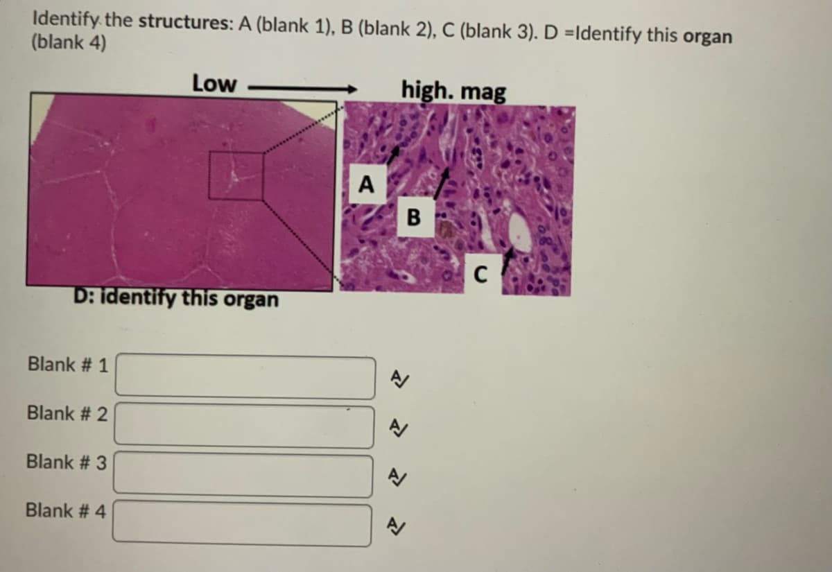 Identify the structures: A (blank 1), B (blank 2), C (blank 3). D =Identify this organ
(blank 4)
Low
high. mag
A
B
D: identify this organ
Blank # 1
Blank # 2
Blank # 3
Blank # 4
