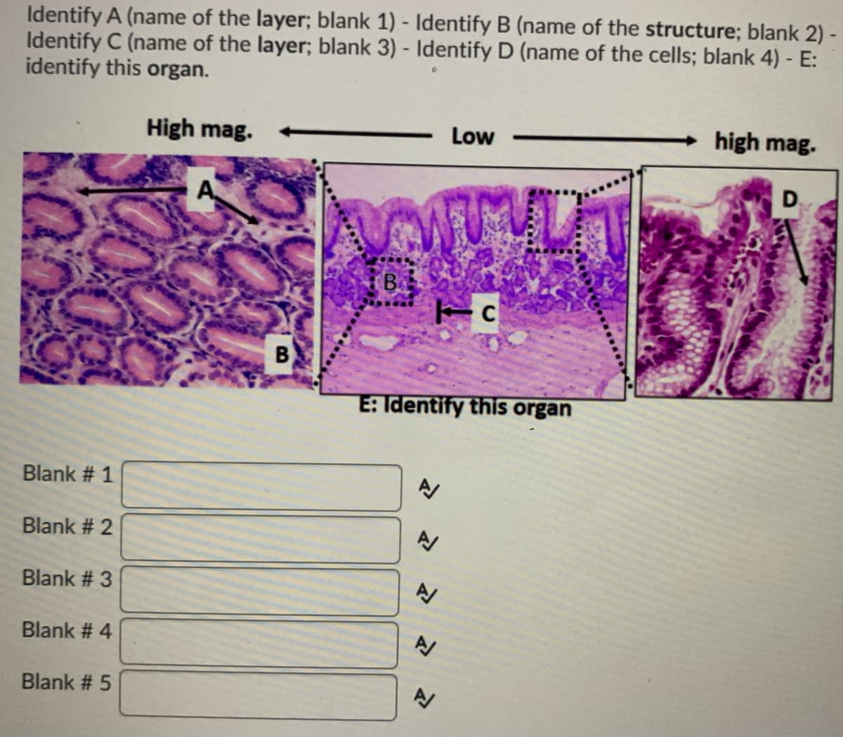 Identify A (name of the layer; blank 1) - Identify B (name of the structure; blank 2) -
Identify C (name of the layer; blank 3) - Identify D (name of the cells; blank 4) - E:
identify this organ.
High mag.
Low
high mag.
D.
B
B
E: Identify this organ
Blank # 1
Blank # 2
Blank # 3
Blank # 4
Blank # 5
