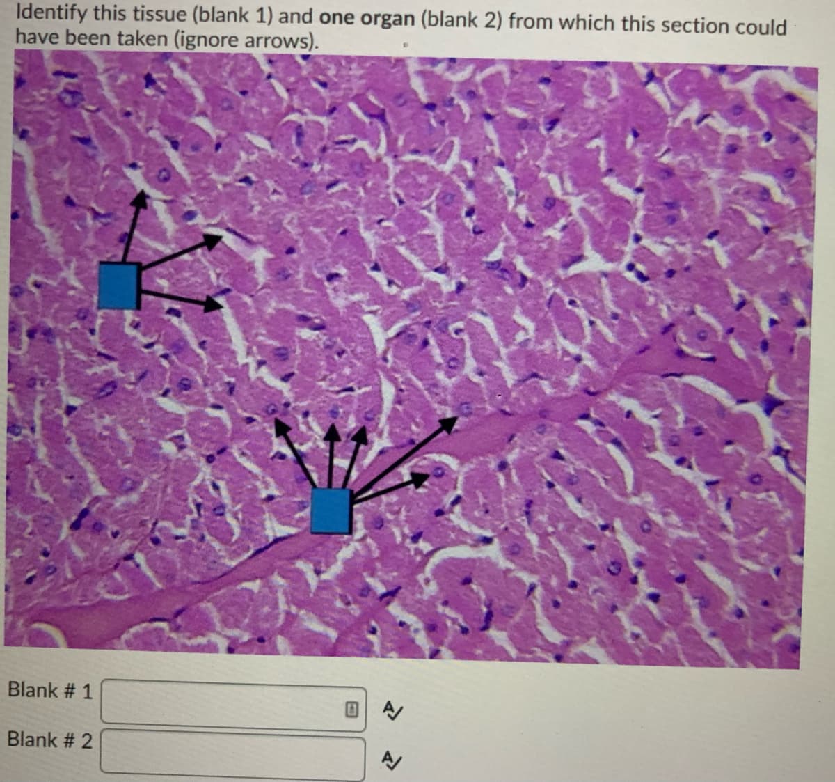 Identify this tissue (blank 1) and one organ (blank 2) from which this section could
have been taken (ignore arrows).
Blank # 1
Blank # 2
