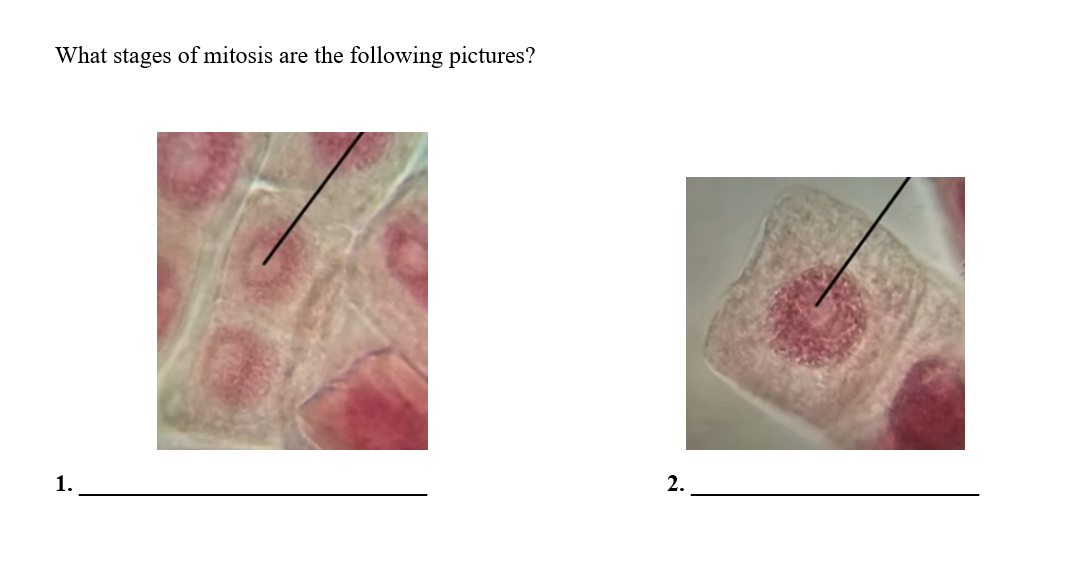 What stages of mitosis are the following pictures?
2.
