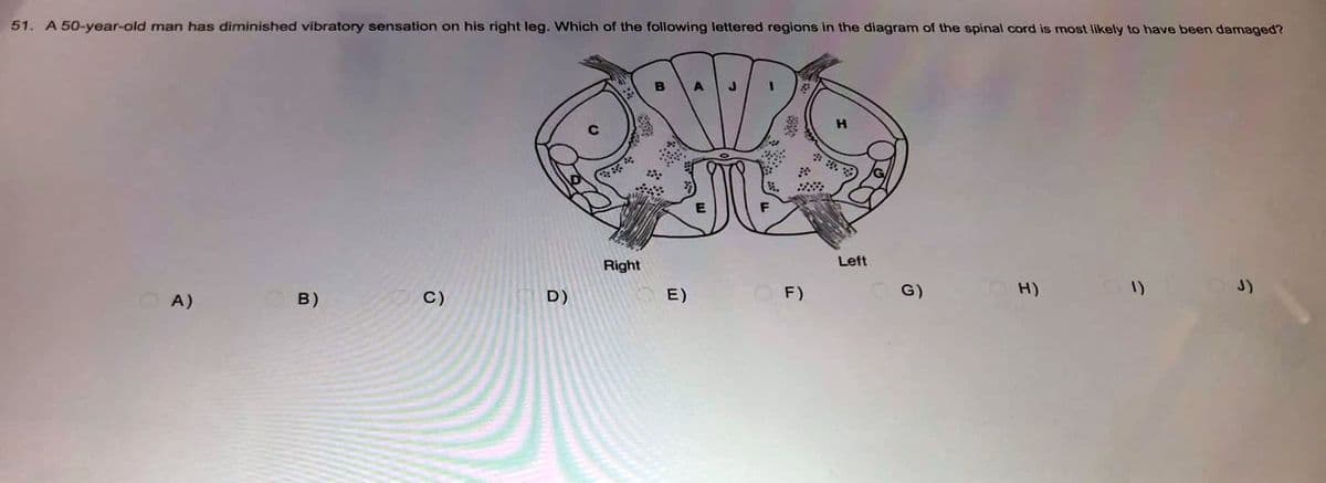 51. A 50-year-old man has diminished vibratory sensation on his right leg. Which of the following lettered regions in the diagram of the spinal cord is most likely to have been damaged?
99
Right
H)
1)
C)
B)
A)
ô
E)
:888:
OF)
Left
G)