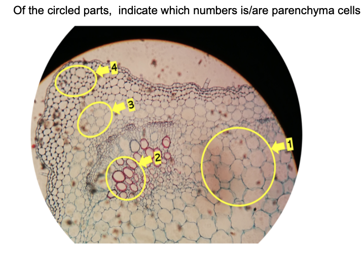 Of the circled parts, indicate which numbers is/are parenchyma cells
1
