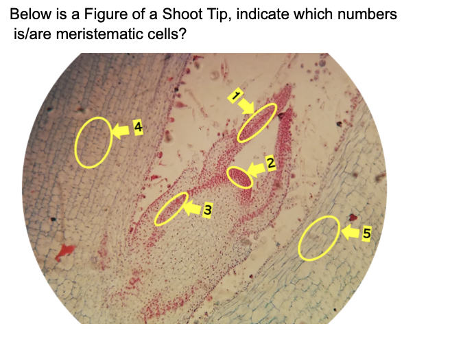 Below is a Figure of a Shoot Tip, indicate which numbers
is/are meristematic cells?
4
13
5.
21
