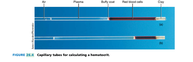 Air
Plasma
Buffy coat
Red blood cells
Clay
(a)
(b)
FIGURE 26.4 Capillary tubes for calculating a hematocrit.
James Hayden/Phototake
