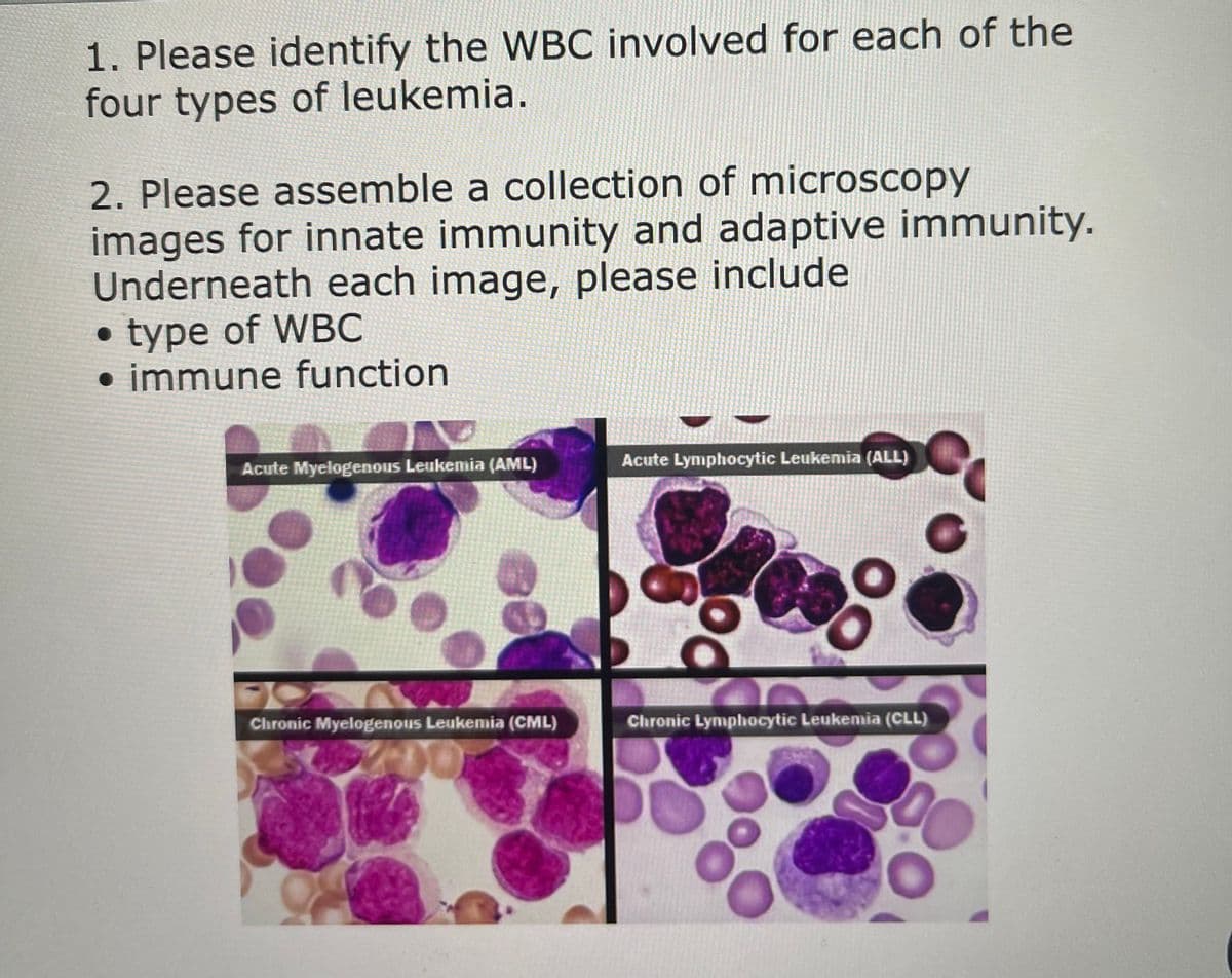 1. Please identify the WBC involved for each of the
four types of leukemia.
2. Please assemble a collection of microscopy
images for innate immunity and adaptive immunity.
Underneath each image, please include
• type of WBC
• immune function
Acute Myelogenous Leukemia (AML)
Acute Lymphocytic Leukemia (ALL)
Chronic Myelogenous Leukemia (CML)
Chronic Lymphocytic Leukemia (CLL)
