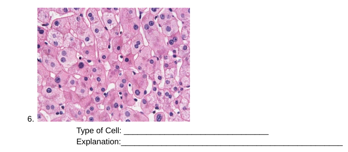 6.
Type of Cell:
Explanation:
