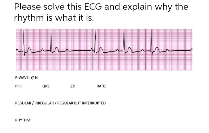 Please solve this ECG and explain why the
rhythm is what it is.
مرسيدسة
P-WAVE: Y/N
PRI:
QRS:
RHYTHM:
QT:
RATE:
REGULAR / IRREGULAR / REGULAR BUT INTERRUPTED
مريه