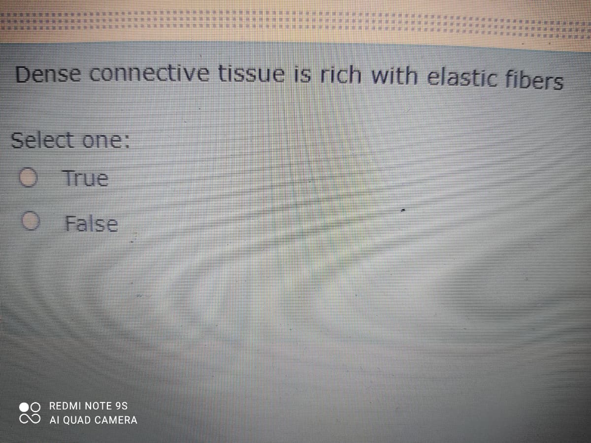 Dense connective tissue is rich with elastic fibers
Select one:
O True
O False
REDMI NOTE 9S
AI QUAD CAMERA
