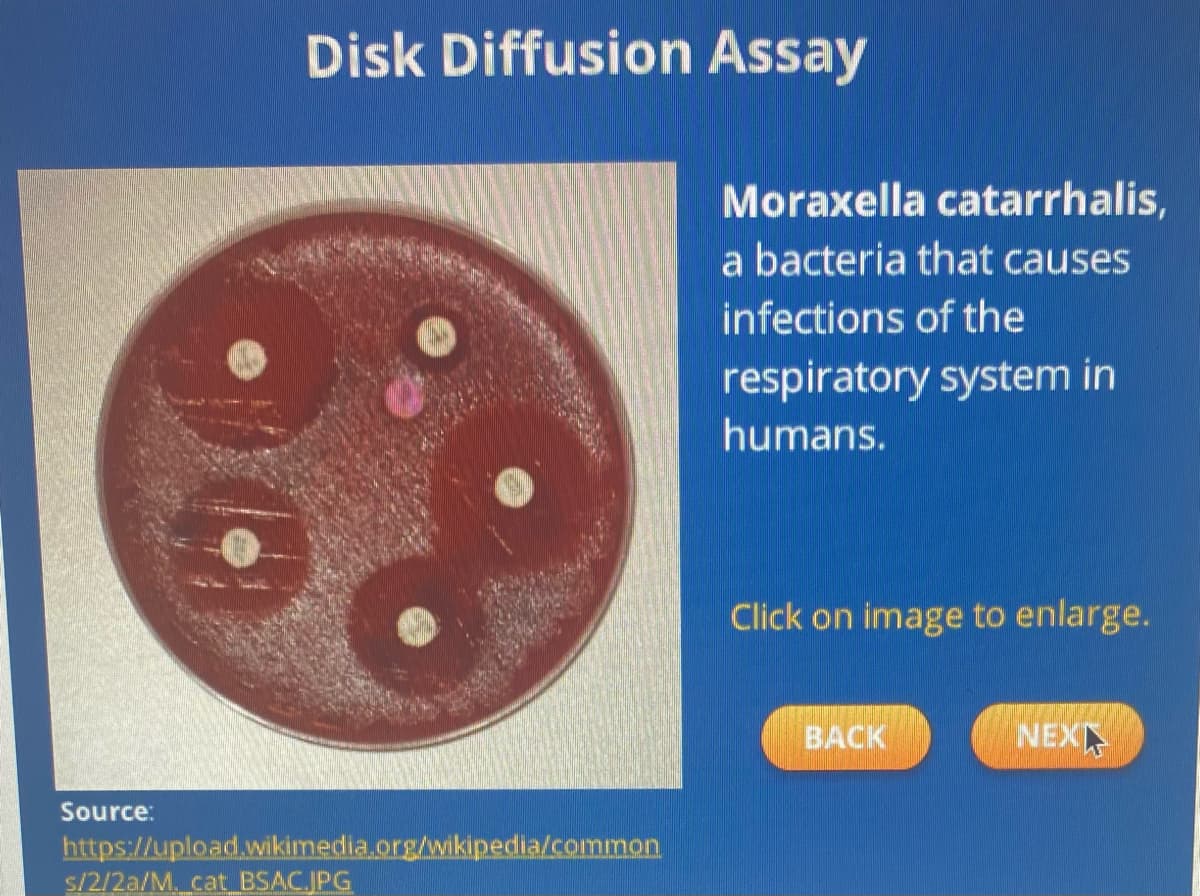 Source:
Disk Diffusion Assay
https://upload.wikimedia.org/wikipedia/common
s/2/2a/M. cat BSAC.JPG
Moraxella catarrhalis,
a bacteria that causes
infections of the
respiratory system in
humans.
Click on image to enlarge.
BACK
NEX
45
