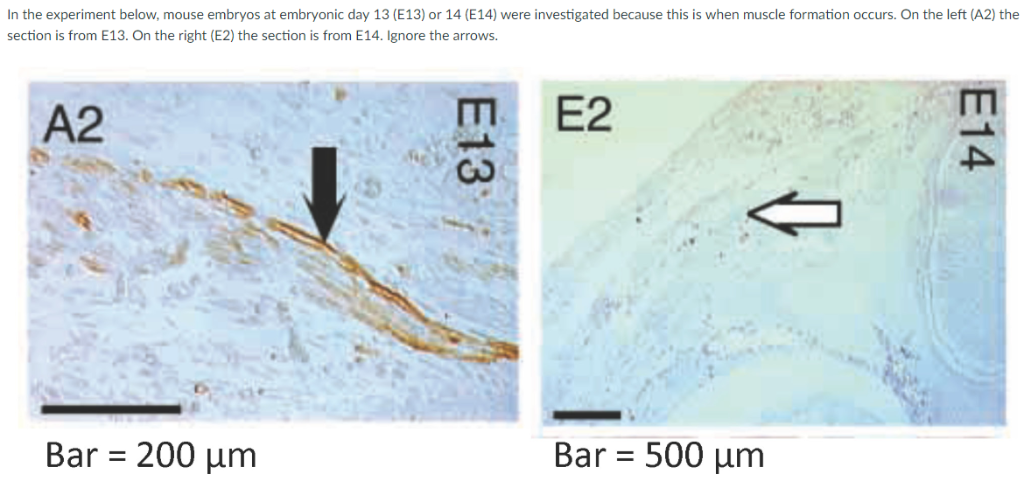 In the experiment below, mouse embryos at embryonic day 13 (E13) or 14 (E14) were investigated because this is when muscle formation occurs. On the left (A2) the
section is from E13. On the right (E2) the section is from E14. Ignore the arrows.
E2
A2
Bar = 200 µm
Bar = 500 µm
E14
E13
