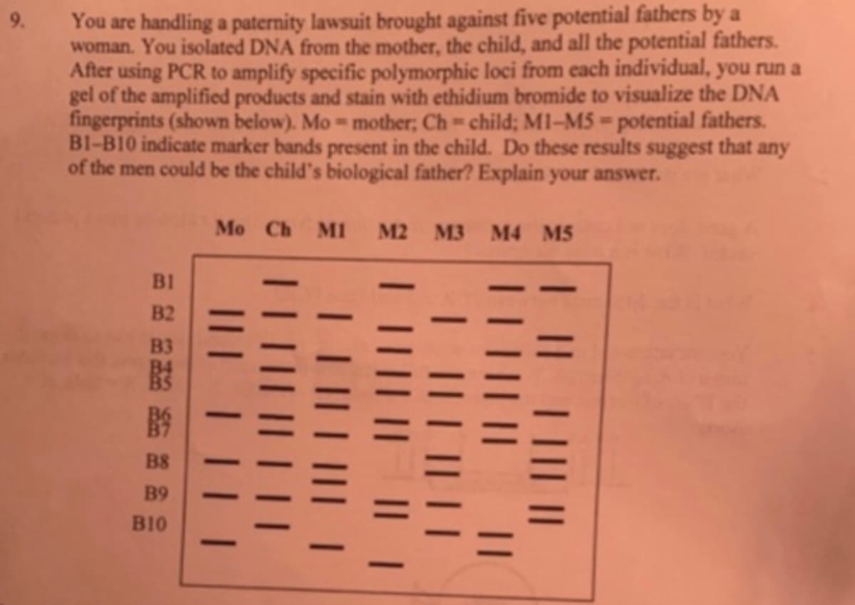 You are handling a paternity lawsuit brought against five potential fathers by a
woman. You isolated DNA from the mother, the child, and all the potential fathers.
After using PCR to amplify specific polymorphic loci from each individual, you run a
gel of the amplified products and stain with ethidium bromide to visualize the DNA
fingerprints (shown below). Mo-mother; Ch child; M1-M5 =potential fathers.
BI-B10 indicate marker bands present in the child. Do these results suggest that any
of the men could be the child's biological father? Explain your answer.
9.
Mo Ch M
M2 M3 M4 M5
B1
B2
B3
B8
B9
B10
E|| ||| ||
| ||| || ||
IIII || || |
I TIL| ||| |
e ||||| || | ||
I|L ||| |
||
