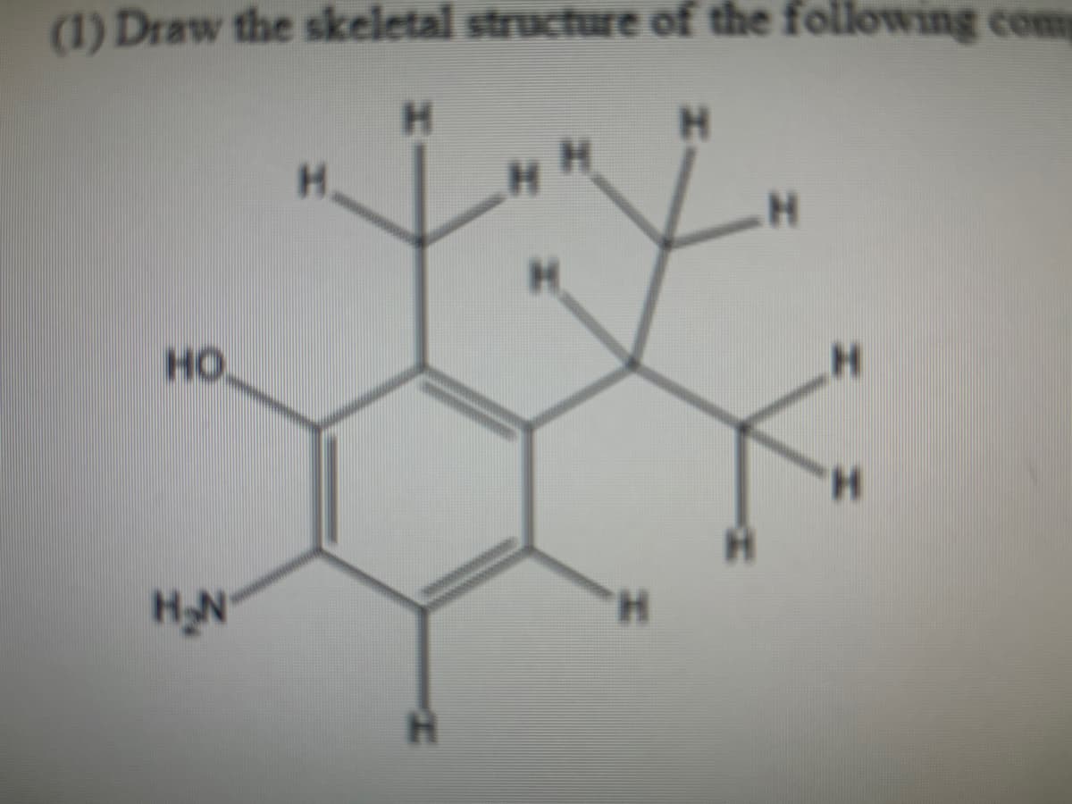 (1) Draw the skeletal structure of the following comp
H
H
HO
H₂N
M
H
HH
H
A
H
H
H