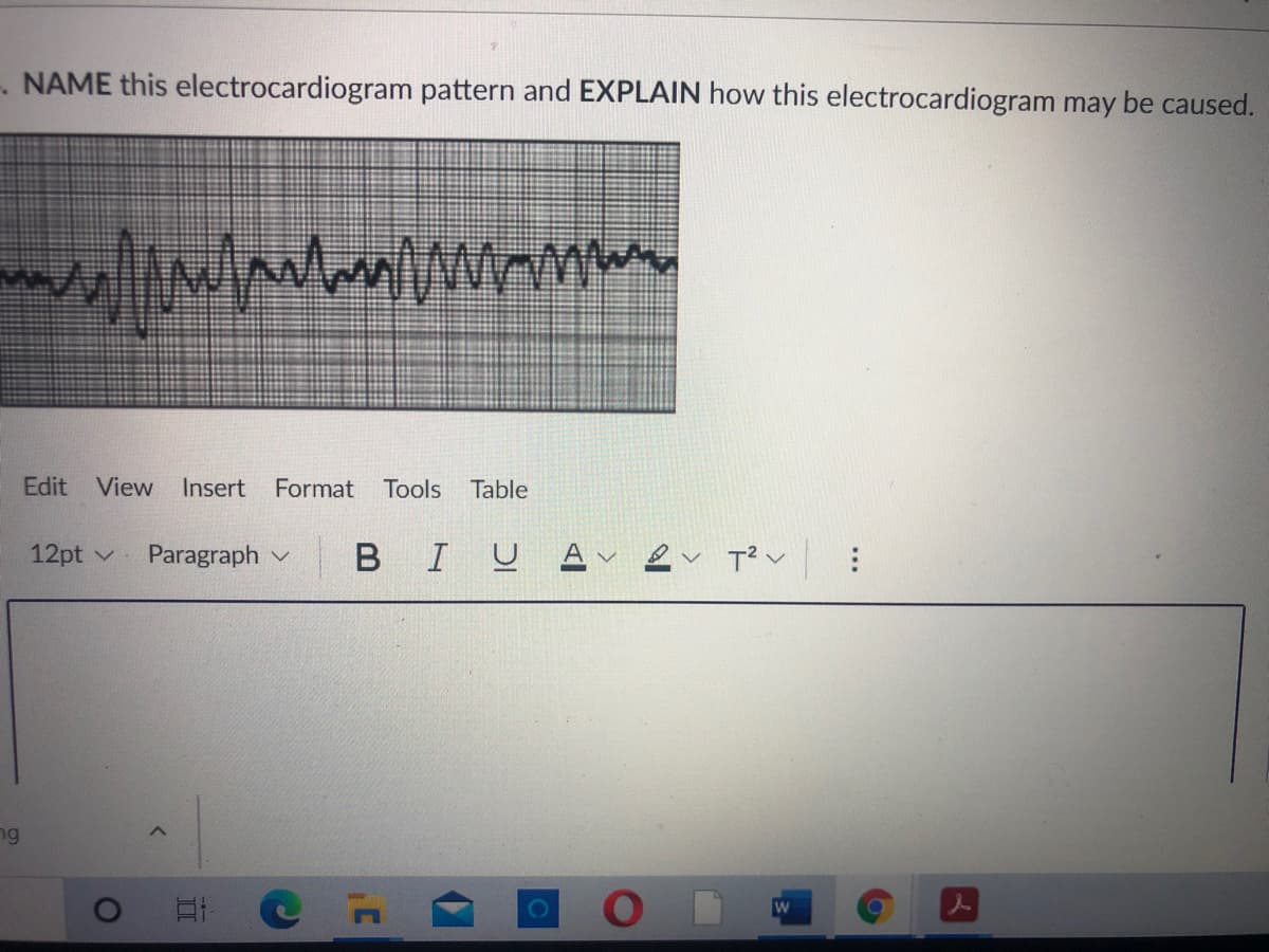 . NAME this electrocardiogram pattern and EXPLAIN how this electrocardiogram may be caused.
Edit View
Insert
Format Tools
Table
12pt v
Paragraph v
BIUAv er T?v :
ng

