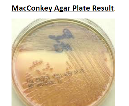 MacConkey Agar Plate Result:
