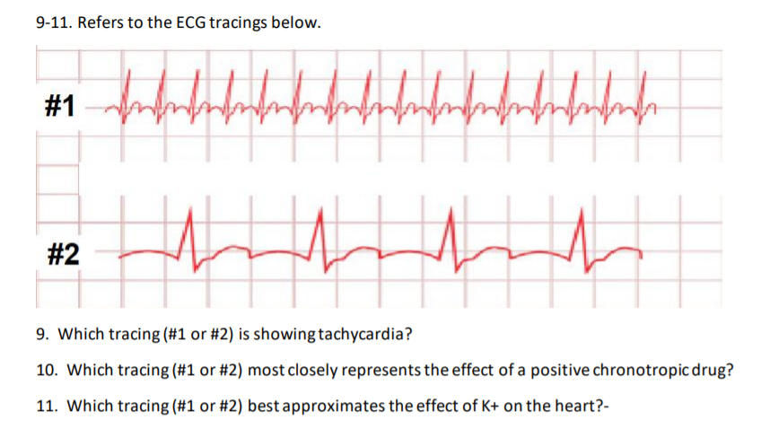 9-11. Refers to the ECG tracings below.
#1
#2
9. Which tracing (#1 or #2) is showing tachycardia?
10. Which tracing (#1 or #2) most closely represents the effect of a positive chronotropic drug?
11. Which tracing (#1 or #2) best approximates the effect of K+ on the heart?-
