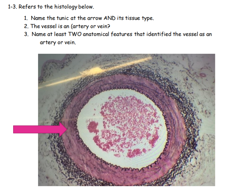 1-3. Refers to the histology below.
1. Name the tunic at the arrow AND its tissue type.
2. The vessel is an (artery or vein?
3. Name at least TWO anatomical features that identified the vessel as an
artery or vein.
