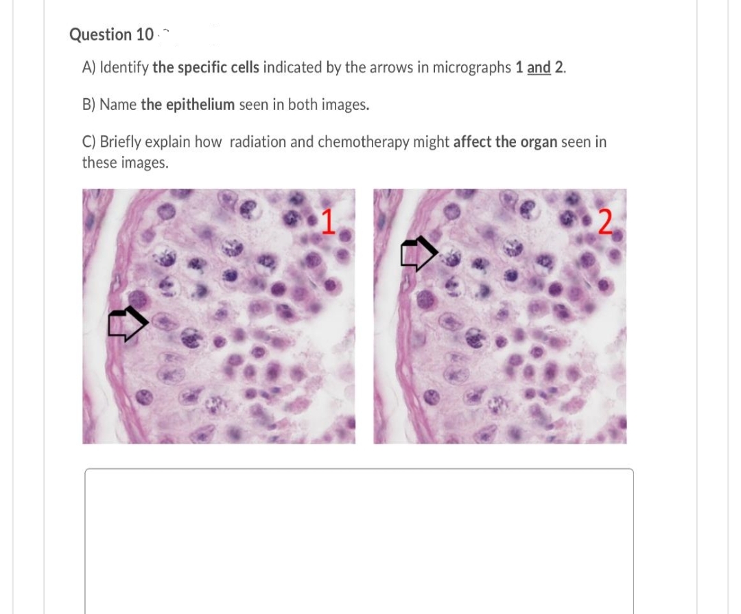 Question 10 -
A) Identify the specific cells indicated by the arrows in micrographs 1 and 2.
B) Name the epithelium seen in both images.
C) Briefly explain how radiation and chemotherapy might affect the organ seen in
these images.
2.
