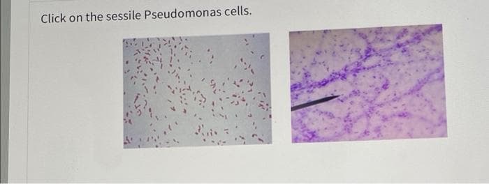 Click on the sessile Pseudomonas cells.
