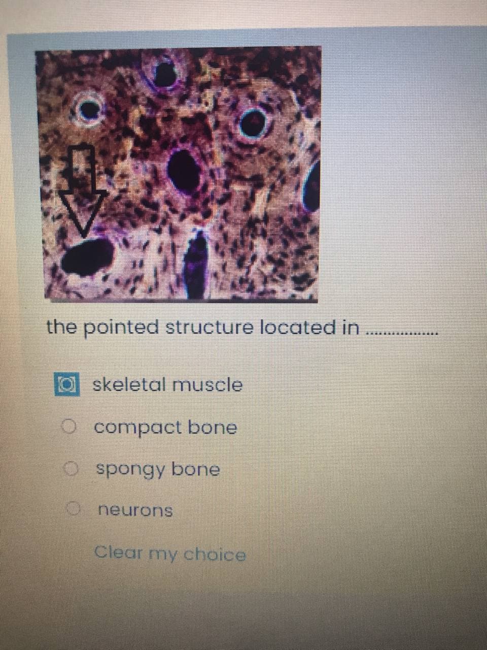the pointed structure located in
skeletal muscle
O compact bone
O spongy bone
neurons
Clear my choice
