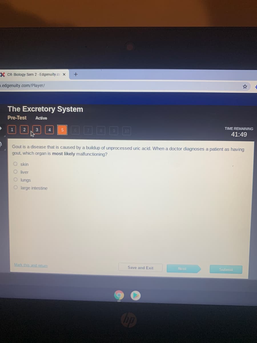 X CR- Biology Sem 2- Edgenuity.co x
m.edgenuity.com/Player/
The Excretory System
Pre-Test
Active
TIME REMAINING
2
3
41:49
Gout is a disease that is caused by a buildup of unprocessed uric acid. When a doctor diagnoses a patient as having
gout, which organ is most likely malfunctioning?
O skin
O liver
O lungs
O large intestine
Mark this and retum
Save and Exit
Next
Submil
