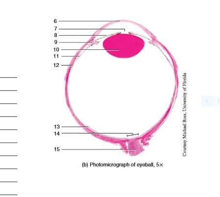 6
7
8
9
10
11
12
13
14
15
(b) Photomicrograph of eyeball, 5x
Courtesy Michael Ross, University of Florida
