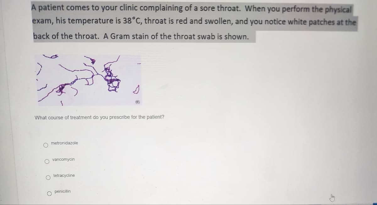 A patient comes to your clinic complaining of a sore throat. When you perform the physical
exam, his temperature is 38°C, throat is red and swollen, and you notice white patches at the
back of the throat. A Gram stain of the throat swab is shown.
What course of treatment do you prescribe for the patient?
O
metronidazole
Ovancomycin
O
O
tetracycline.
penicillin