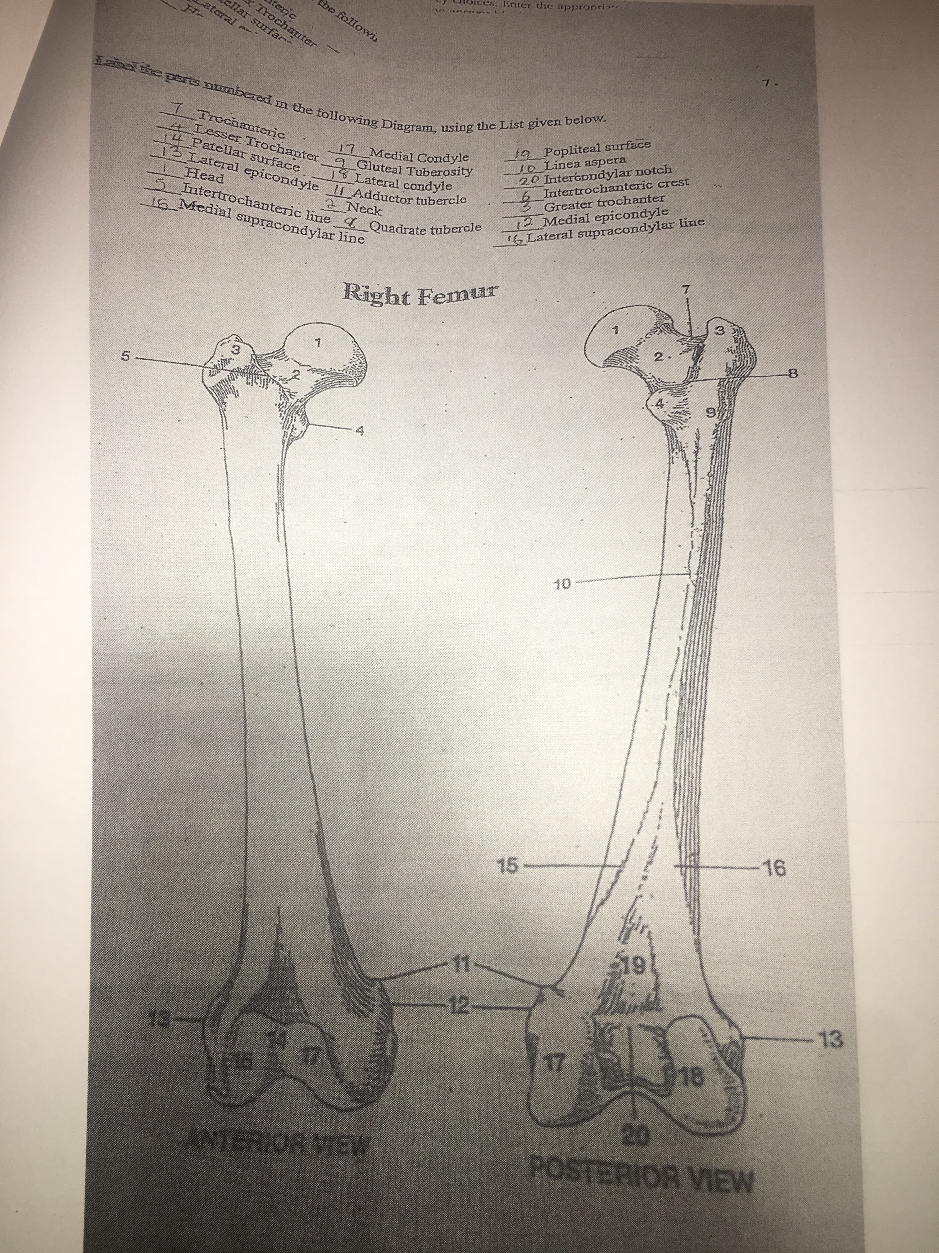 noices, Enter the appronri
be followi
rerjc
Trochanter
cllar surfac
ateral
7.
eparis mmbered m the following Diagram, using the List given below.
19 Popliteal surface
Jo Linea aspera
20 Interconadylar notch
Intertrochanteric crest
7 Irochanteric
4Lesser Trochanter
14 Patellar surface
19.
17 Medial Condyle
9 Gluteal Tuberosity
18 Lateral condyle
13 Lateral epicondyle I Adductor tubercle
12 Medial epicondyle
16 Lateral supracondylar line
Greater trochanter
Head
SIntertrochanteric line Quadrate tubercle
2 Neck
16_Medial supracondylar line
Right Femur
2.
-8
4.
10
16
15-
11
12-
13
13-
18
17
17
20
POSTERIOR VIEW
ANTERIOR VIEW
