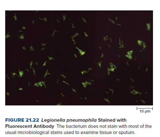 10 μ
FIGURE 21.22 Legionella pneumophila Stained with
Fluorescent Antibody The bacterium does not stain with most of the
usual microbiological stains used to examine tissue or sputum.

