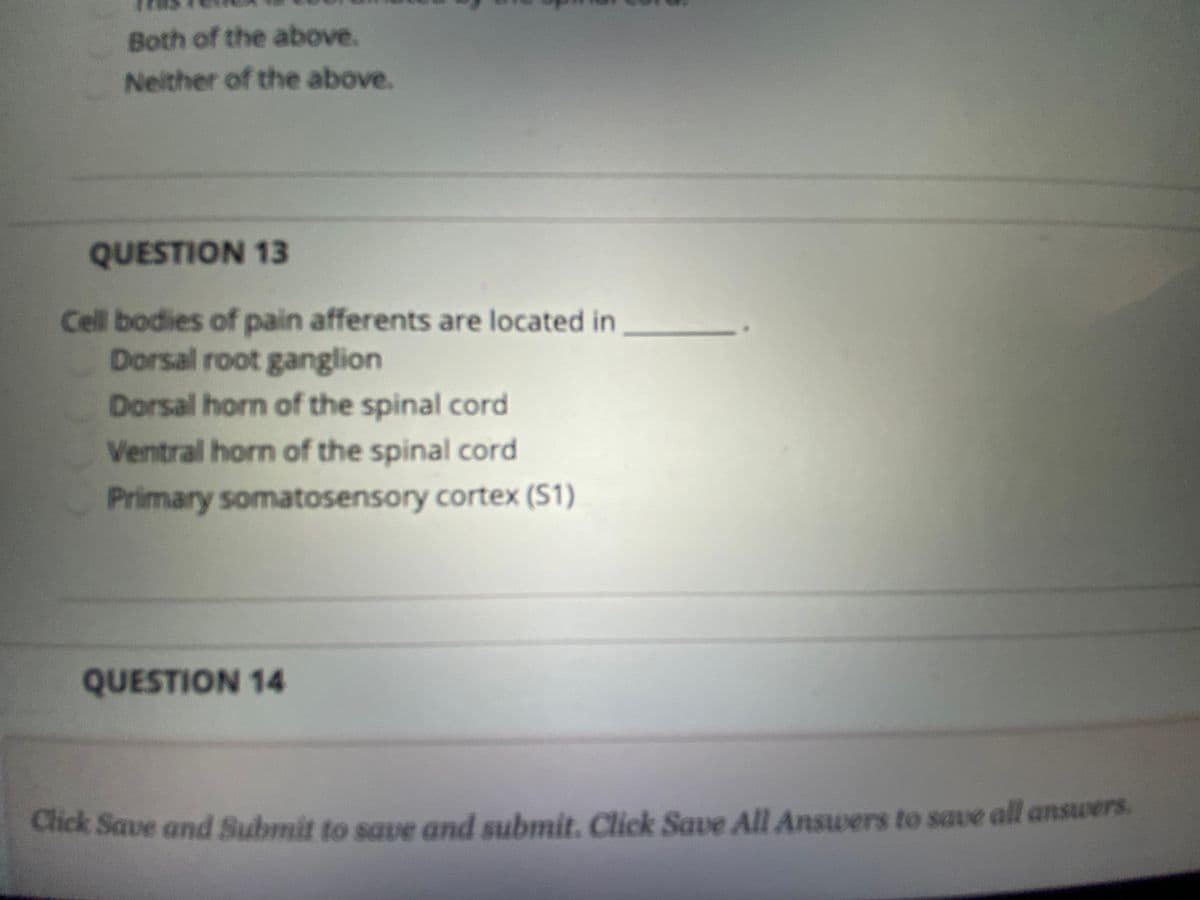 Both of the above.
Neither of the above.
QUESTION 13
Cell bodies of pain afferents are located in
Dorsal root ganglion
Dorsal horn of the spinal cord
Ventral horn of the spinal cord
Primary somatosensory cortex (S1)
QUESTION 14
Click Save and Submit to save and submit. Click Save All Answers to save all answers.