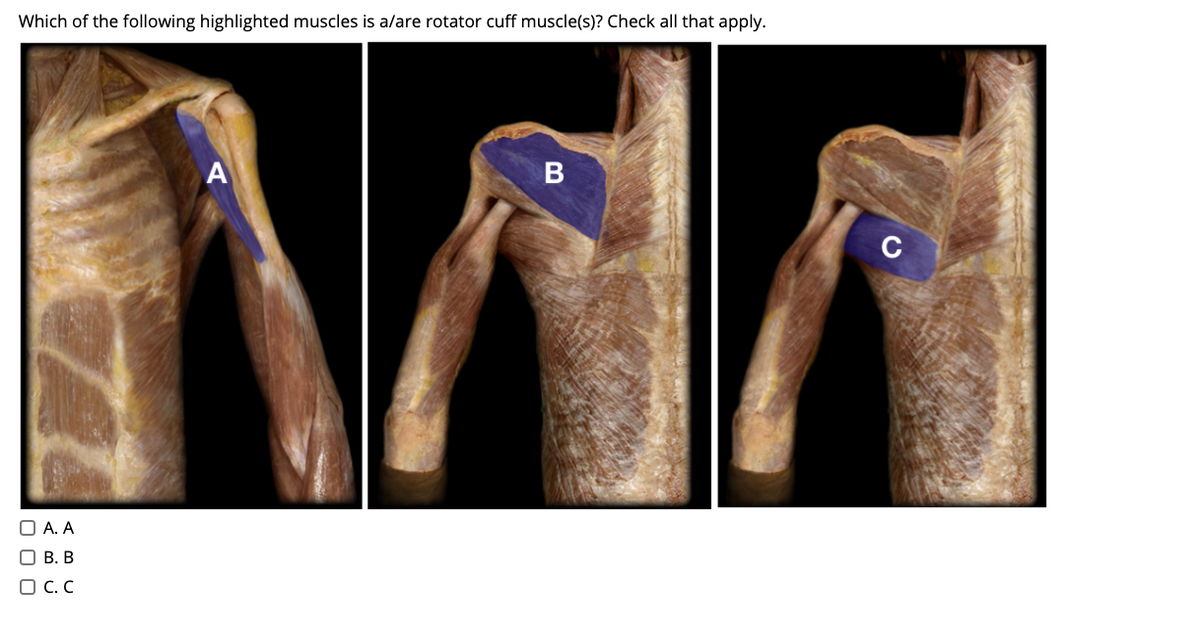 Which of the following highlighted muscles is a/are rotator cuff muscle(s)? Check all that apply.
C
O A. A
О В. В
O C. C
