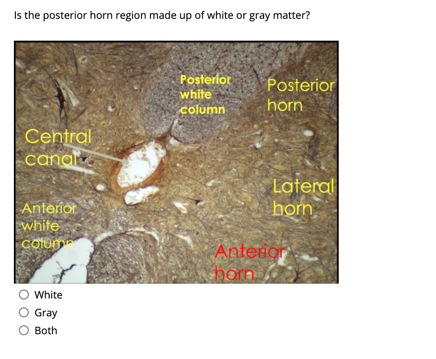 Is the posterior horn region made up of white or gray matter?
Posterior
white
Posterior
column
horn
Central
canal
Lateral
hom
| Anterior
white
Column
Anterion
horn
White
Gray
Both

