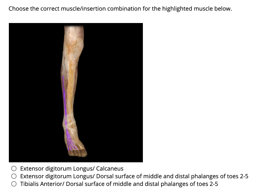 Choose the correct muscle/insertion combination for the highlighted muscle below.
O Extensor digitorum Longus/ Calcaneus
Extensor digitorum Longus/ Dorsal surface of middle and distal phalanges of toes 2-5
O Tibialis Anterior/ Dorsal surface of middle and distal phalanges of toes 2-5
