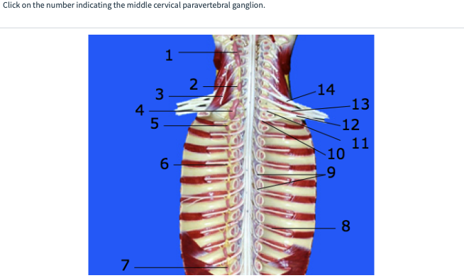 Click on the number indicating the middle cervical paravertebral ganglion.
7
4-
3
5
1
6
2
-14
13
-12
-10
-9
11
8