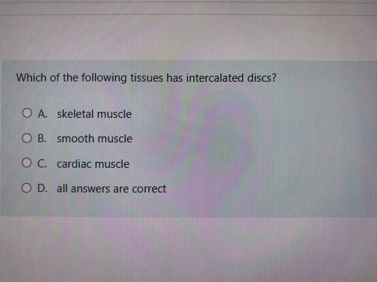 Which of the following tissues has intercalated discs?
O A. skeletal muscle
O B. smooth muscle
O C. cardiac muscle
O D. all answers are correct
