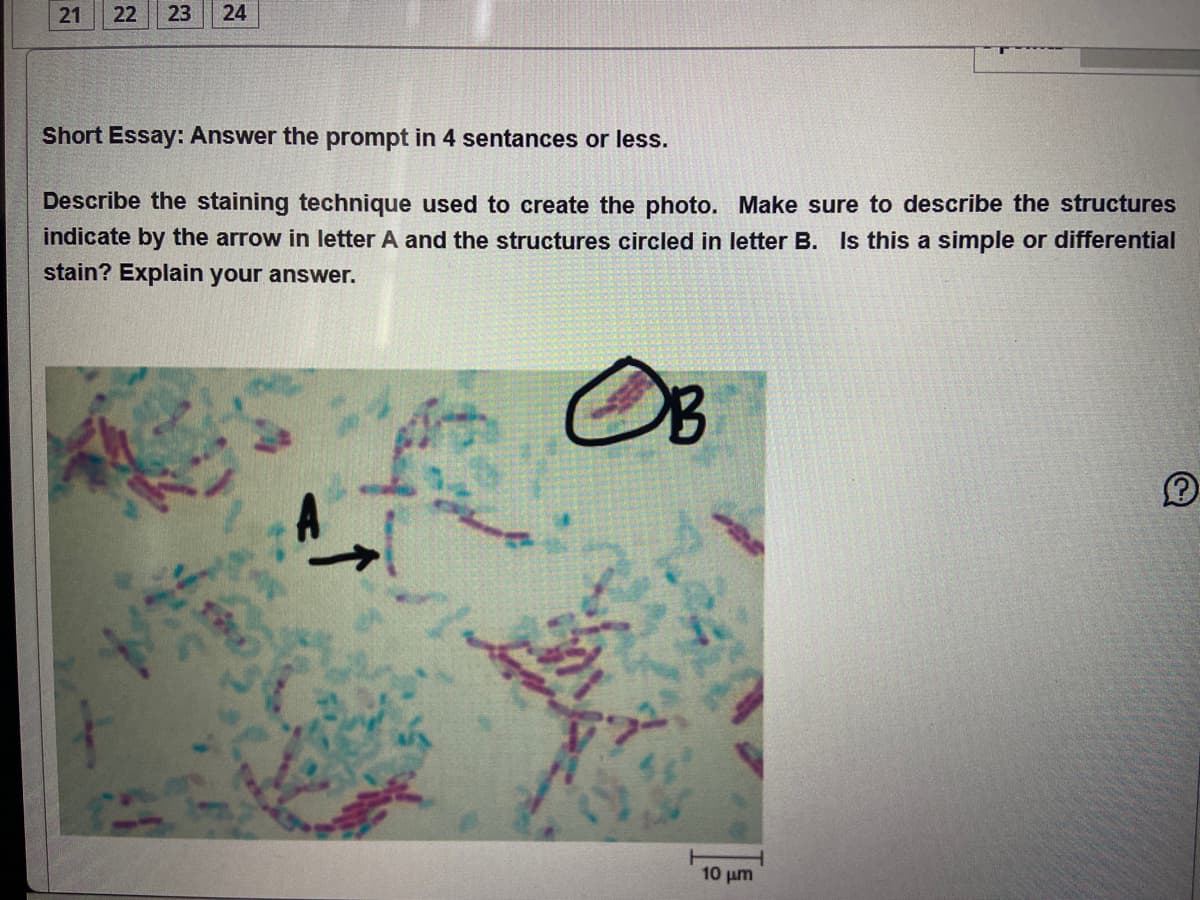 21 22 23 24
Short Essay: Answer the prompt in 4 sentances or less.
Describe the staining technique used to create the photo. Make sure to describe the structures
indicate by the arrow in letter A and the structures circled in letter B. Is this a simple or differential
stain? Explain your answer.
1-
OB
10 μm