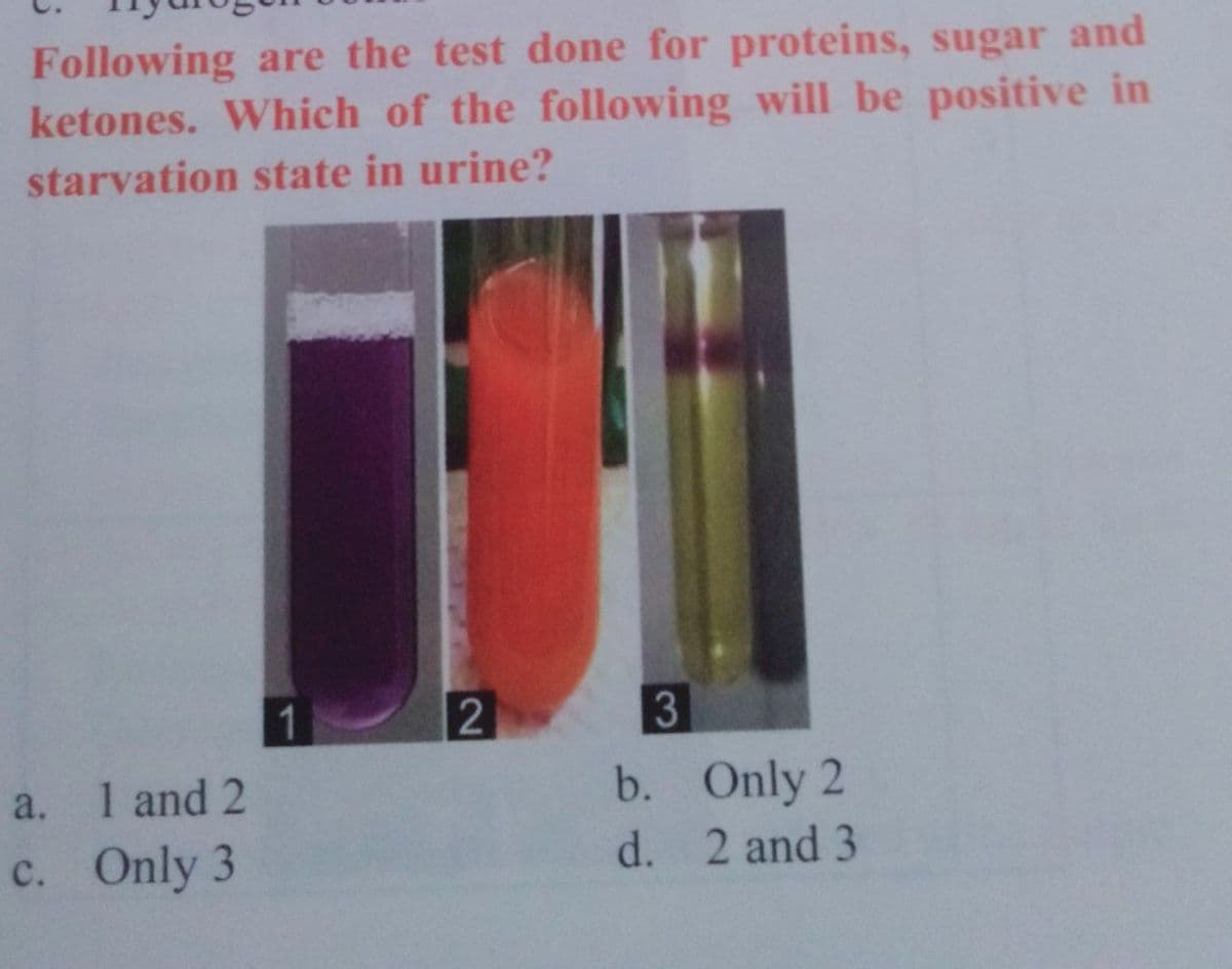 Following are the test done for proteins, sugar and
ketones. Which of the following will be positive in
starvation state in urine?
3
1 and 2
b. Only 2
a.
c. Only 3
d. 2 and 3
2]
