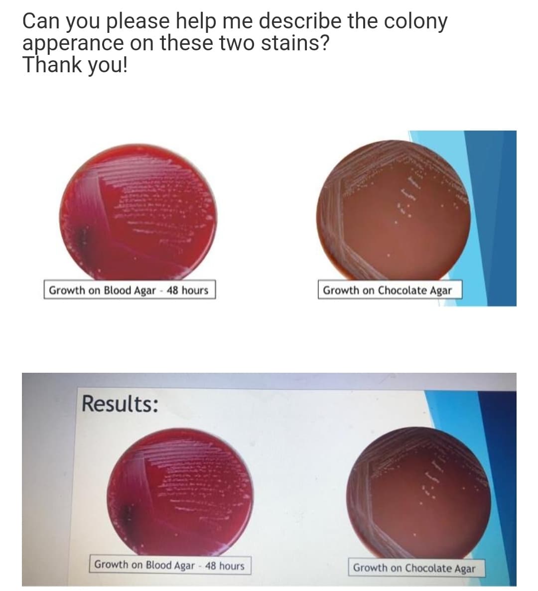 Can you please help me describe the colony
apperance on these two stains?
Thank you!
Growth on Blood Agar - 48 hours
Growth on Chocolate Agar
Results:
Growth on Blood Agar 48 hours
Growth on Chocolate Agar
