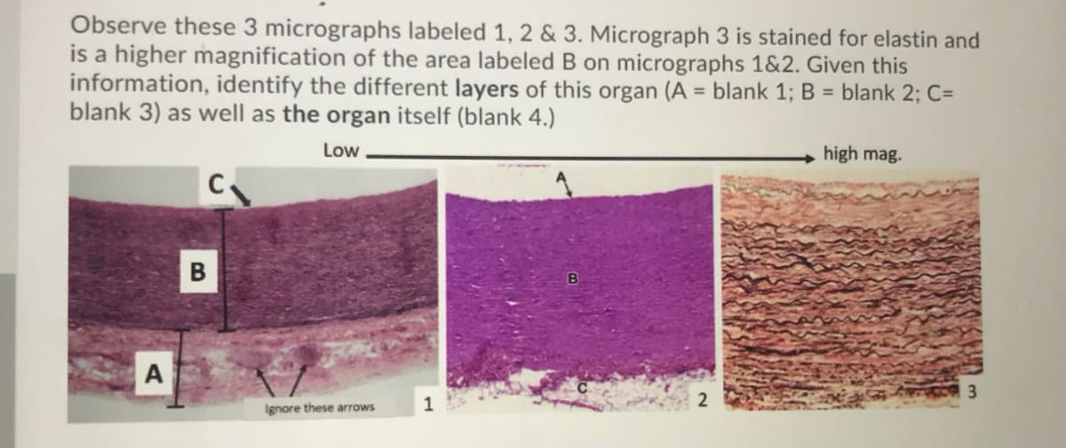 Observe these 3 micrographs labeled 1, 2 & 3. Micrograph 3 is stained for elastin and
is a higher magnification of the area labeled B on micrographs 1&2. Given this
information, identify the different layers of this organ (A = blank 1; B = blank 2; C=
blank 3) as well as the organ itself (blank 4.)
Low
high mag.
В
A
3.
1
2
Ignore these arrows
