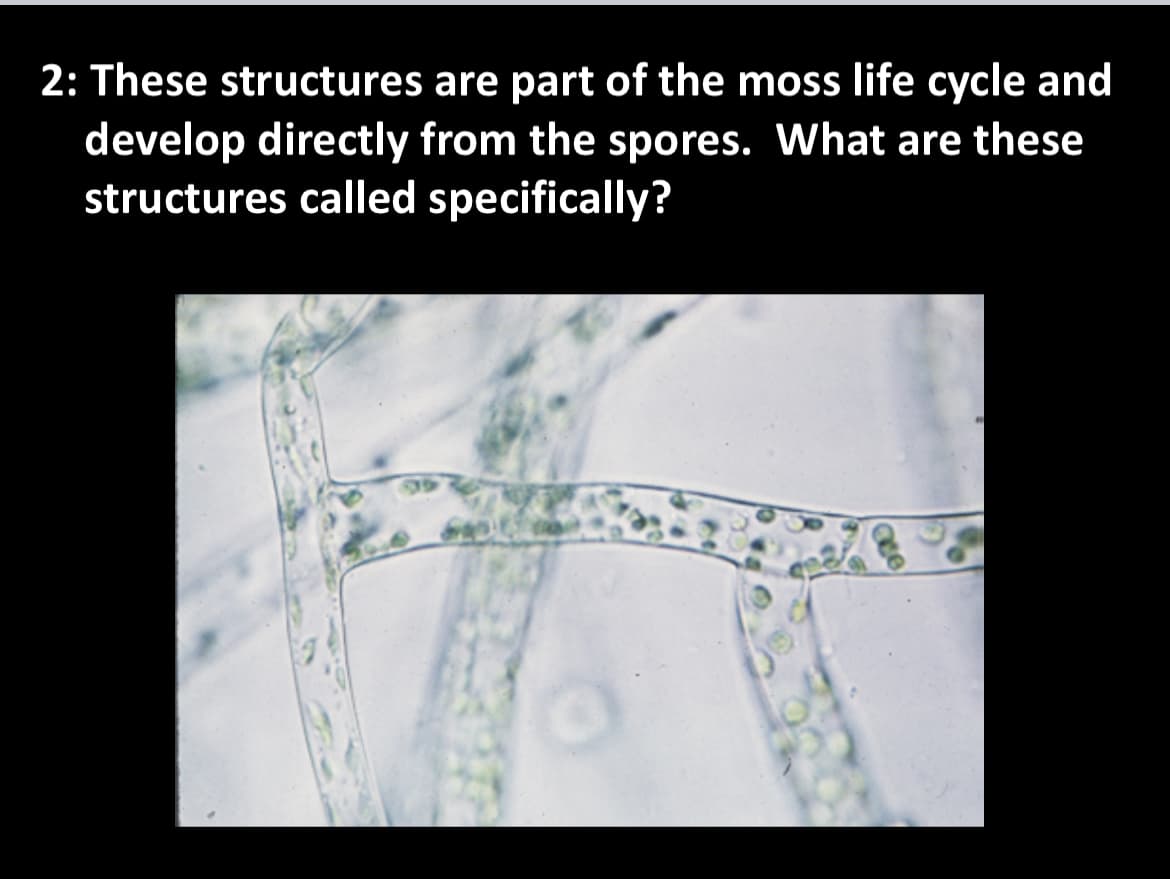 2: These structures are part of the mos life cycle and
develop directly from the spores. What are these
structures called specifically?
