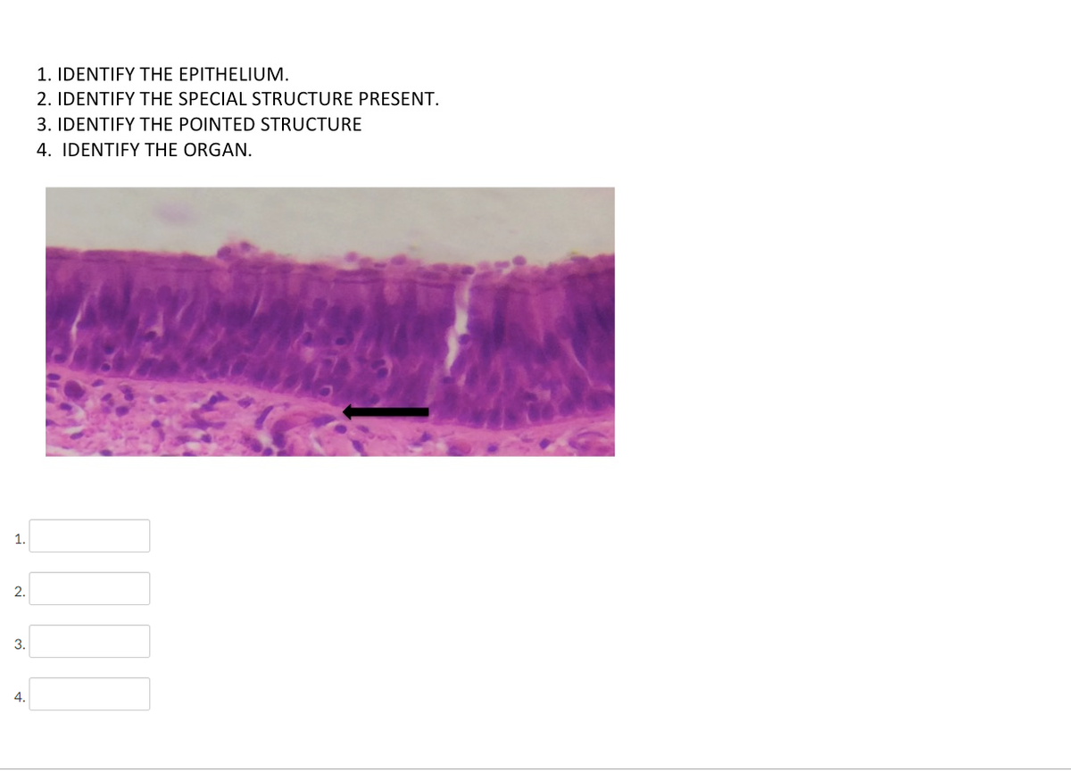 1. IDENTIFY THE EPITHELIUM.
2. IDENTIFY THE SPECIAL STRUCTURE PRESENT.
3. IDENTIFY THE POINTED STRUCTURE
4. IDENTIFY THE ORGAN.
1.
2.
3.
4.
