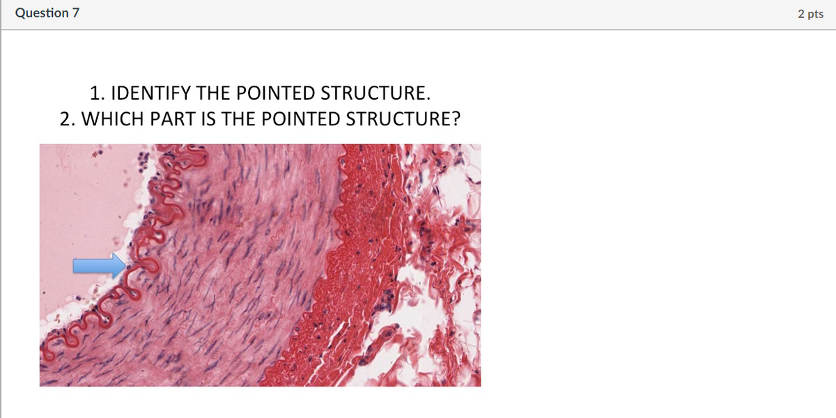 Question 7
2 pts
1. IDENTIFY THE POINTED STRUCTURE.
2. WHICH PART IS THE POINTED STRUCTURE?
