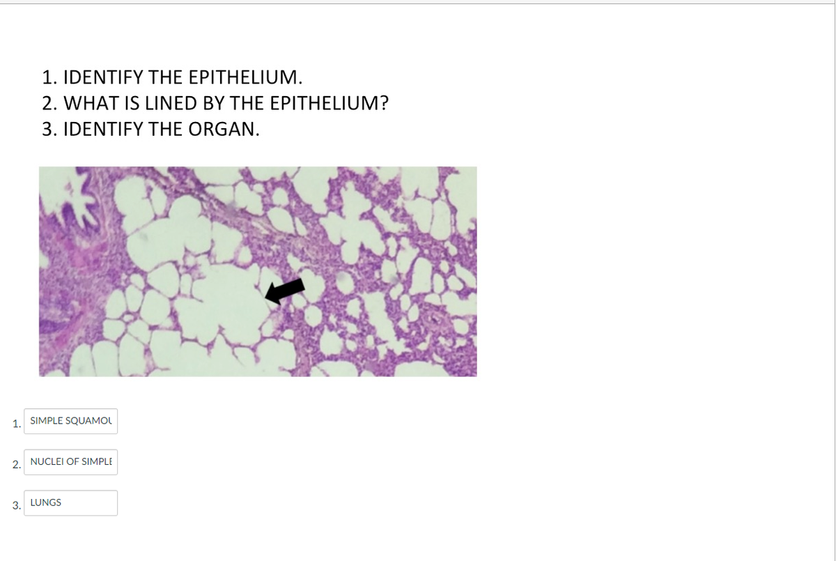 1. IDENTIFY THE EPITHELIUM.
2. WHAT IS LINED BY THE EPITHELIUM?
3. IDENTIFY THE ORGAN.
1. SIMPLE SQUAMOL
2.
NUCLEI OF SIMPLE
3.
LUNGS
