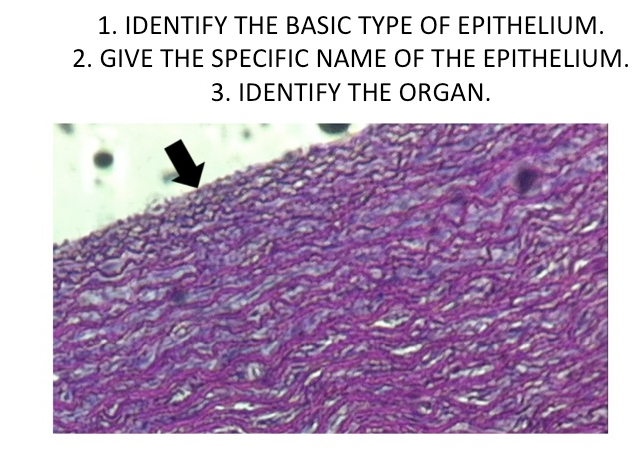 1. IDENTIFY THE BASIC TYPE OF EPITHELIUM.
2. GIVE THE SPECIFIC NAME OF THE EPITHELIUM.
3. IDENTIFY THE ORGAN.
