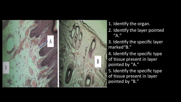 1. Identify the organ.
|2. Identify the layer pointed
"А."
A
3. Identify the specific layer
marked"B."
4. Identify the specific type
of tissue present in layer
B
pointed by "A."
5. Identify the specific type
of tissue present in layer
pointed by "B."
B
