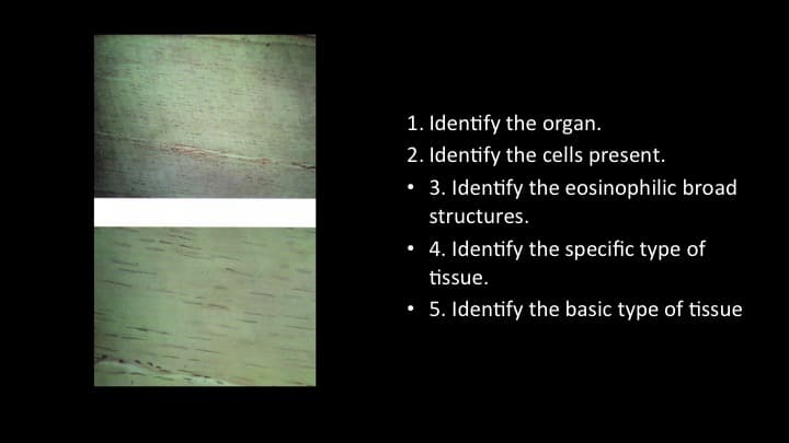 1. Identify the organ.
2. Identify the cells present.
3. Identify the eosinophilic broad
structures.
• 4. Identify the specific type of
tissue.
• 5. Identify the basic type of tissue
