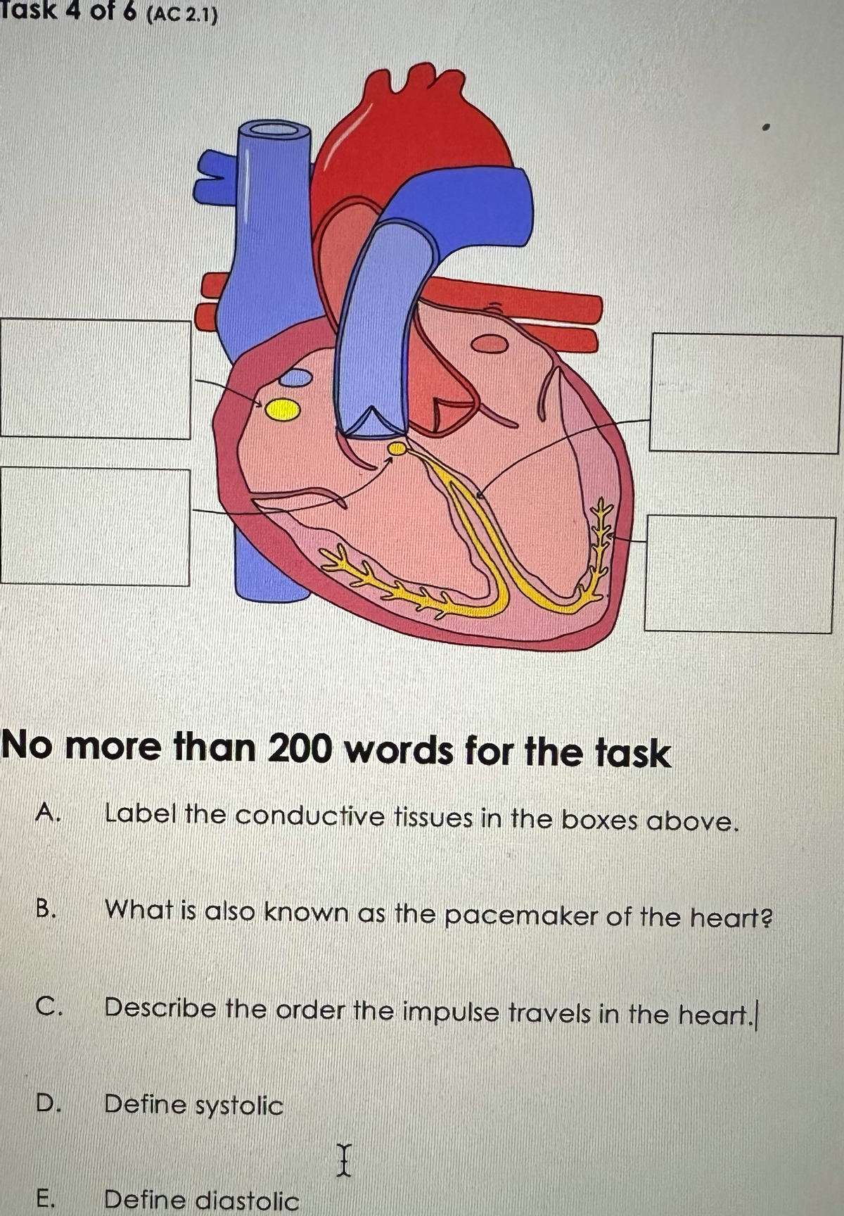 Task 4 of 6 (AC 2.1)
No more than 200 words for the task
A. Label the conductive tissues in the boxes above.
B. What is also known as the pacemaker of the heart?
Ü
C.
Describe the order the impulse travels in the heart.
D. Define systolic
E. Define diastolic
I